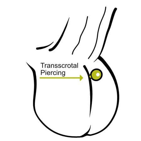 Transscrotal Piercing