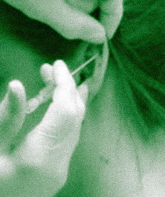 Helix Piercing Stechen lassen Erfahrung