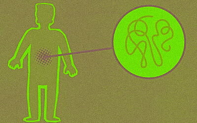 Bauchnabelpiercing entzündet – Alles über eitrige &amp; entzündete Bauchnabelpiercings - Bauchnabelpiercing entzündet | Was tun?